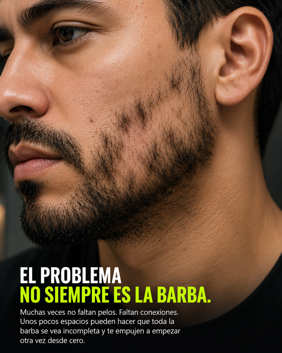 El problema no siempre es la barba.